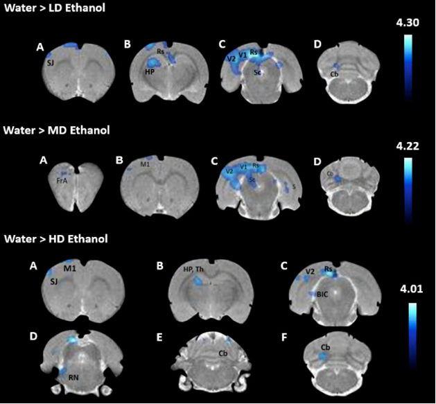 Изменение активности в разных зонах мозга в зависимости от дозы спирта в группах алкоголизированных крыс по сравнению с группами контроля (LD – низкая доза, MD – средняя доза, HD – высокая доза). Credit: Panayotis K. Thanos et al. / Metabolic Brain Disease 2022