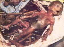 Аборт - изуродованное тельце младенца