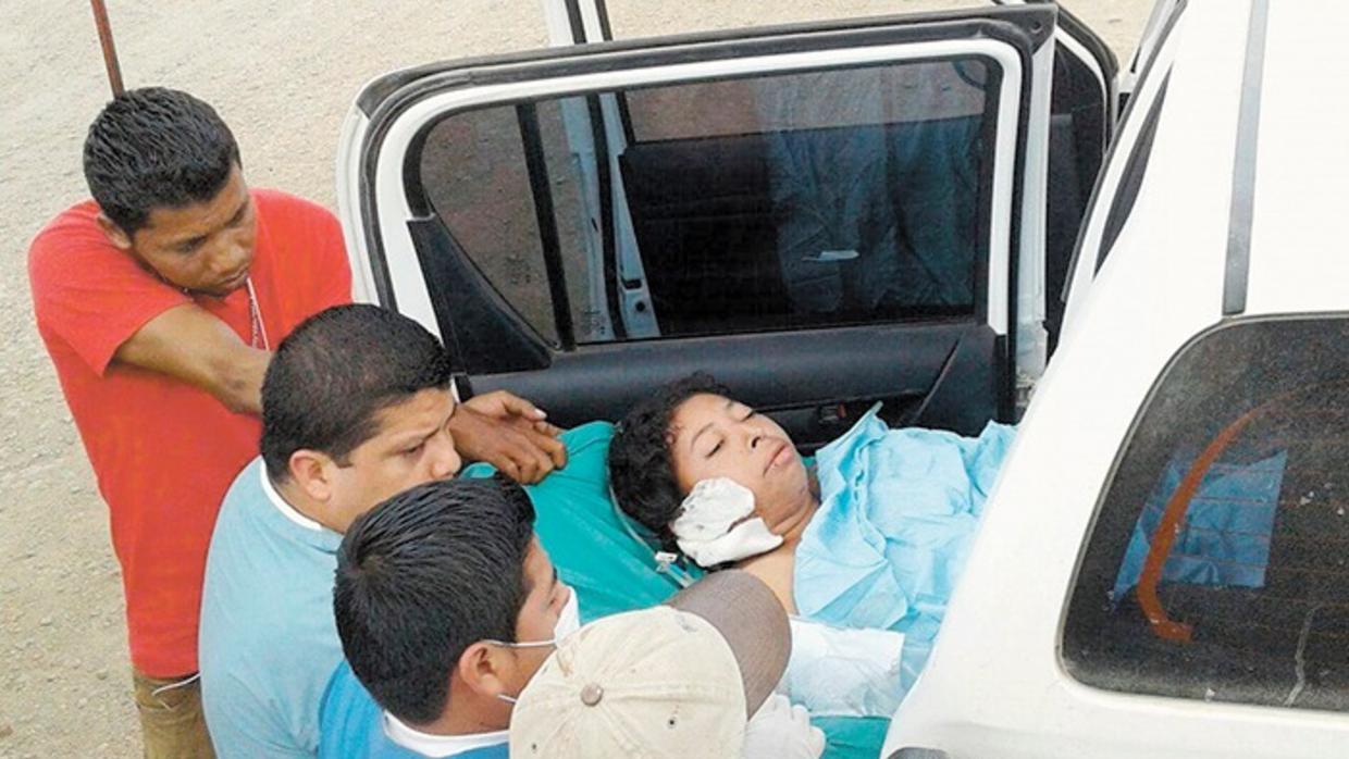 Вильму Трухильо укладывают в машину скорой помощи. Фото Hoy.com