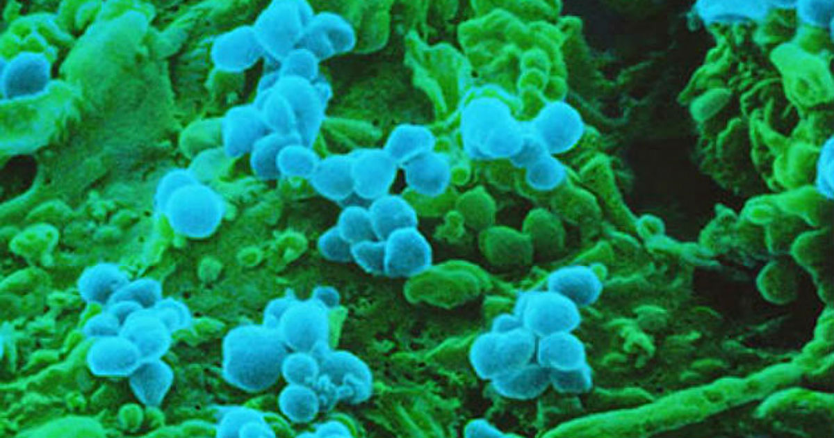 Вирус кори (синий) поражает В-клетки, отвечающие за иммунную память
